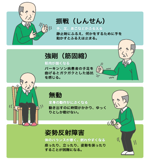 パーキンソン病について