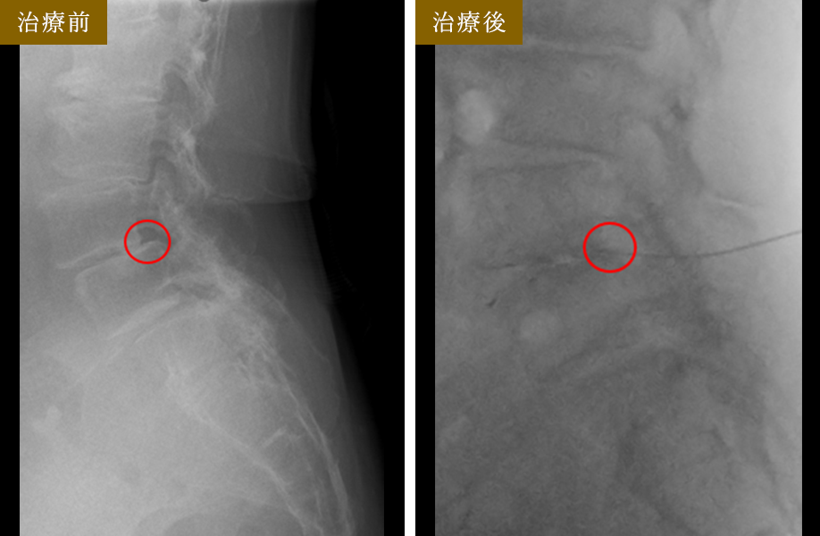 治療前 治療後