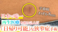 【日帰り腰痛治療】腰部脊柱管狭窄症がその日に治る！！再生医療を組み合わせた「日本で唯一可能な治療法」とは？