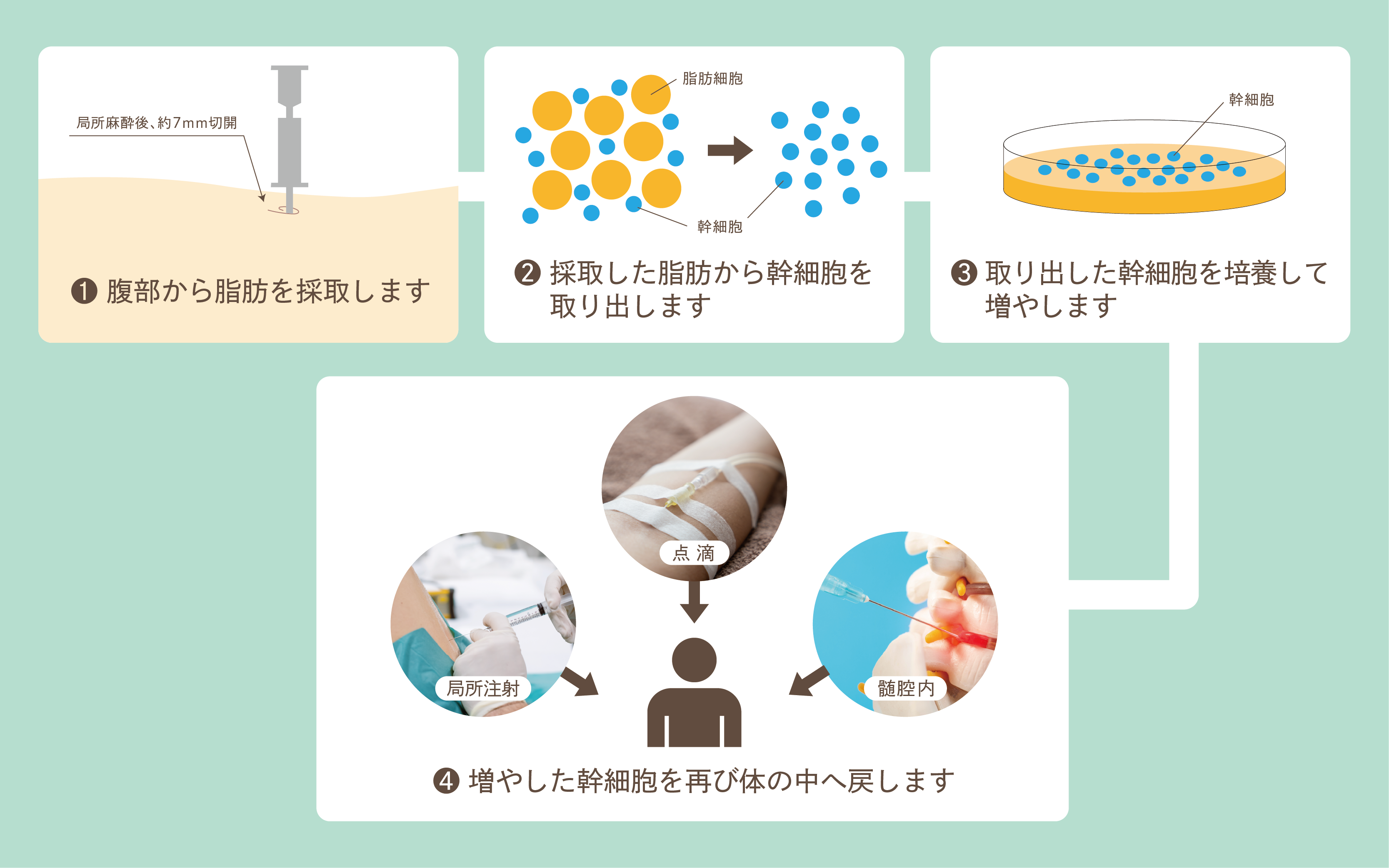 再生医療について