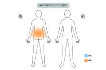 60代女性「腰椎すべり症と椎間板変性が原因の腰痛を再生医療『PDR（経皮的椎間板再生治療）』を使って治療した症例」