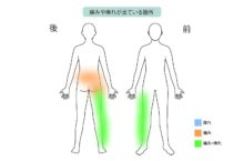 70代男性「腰部脊柱管狭窄症が原因の腰痛を『PEL（脊柱管狭窄症内視鏡下手術）』と再生医療『PRP療法』で治療した症例